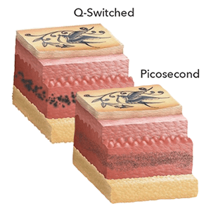 ink-shattering ink-shattering