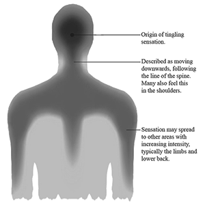Auditory-tactile synesthesia