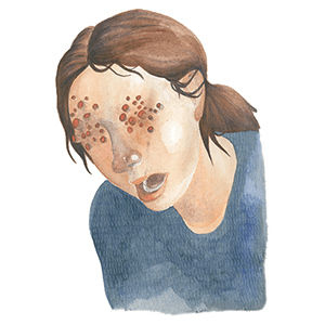 trypophobia by jordan gaza